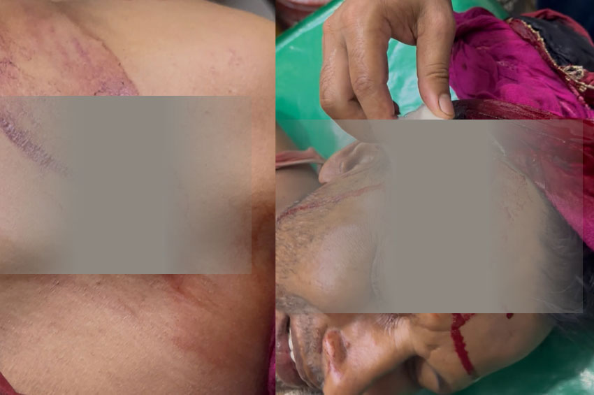 জগন্নাথপুরে জমি বিরোধে সংঘর্ষ, আহত ১৫