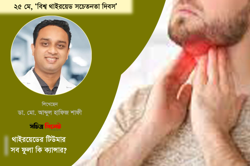 থাইরয়েডের টিউমার: সব ফুলা কি ক্যান্সার? 
